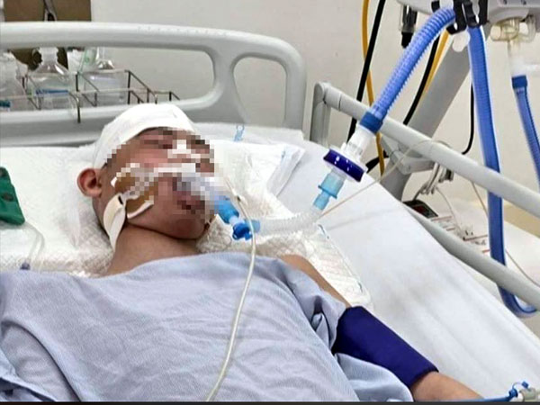 Ảnh bìa bài viết 928303