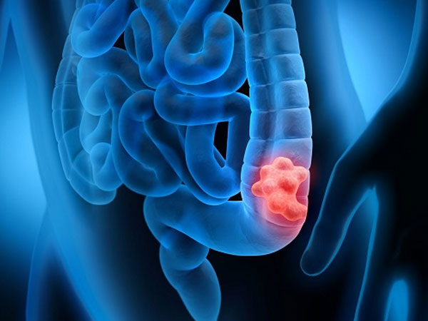 Ảnh bìa bài viết 928149