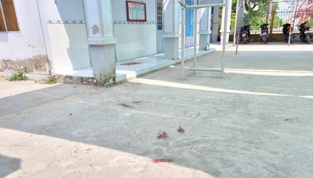 Ảnh bìa bài viết 931472