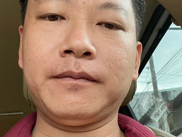 Ảnh bìa bài viết 934080