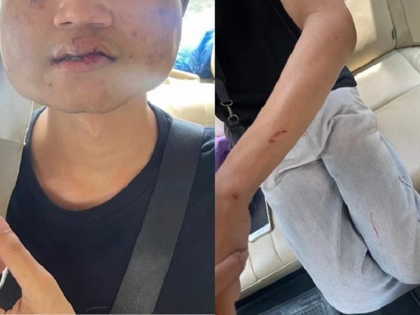 Ảnh bìa bài viết 938130