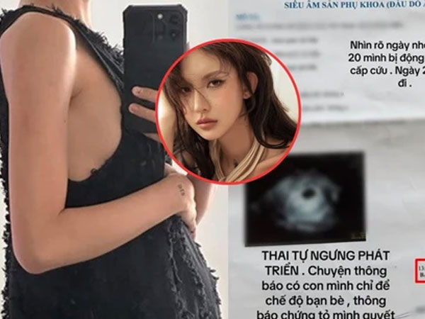 Ảnh bìa bài viết 948653
