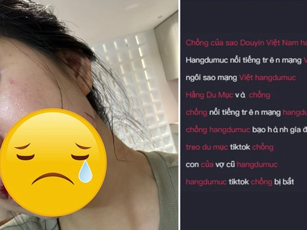 Ảnh bìa bài viết 950632