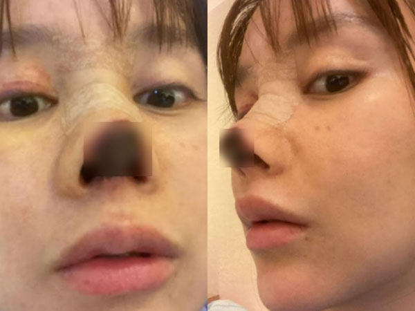Ảnh bìa bài viết 953414