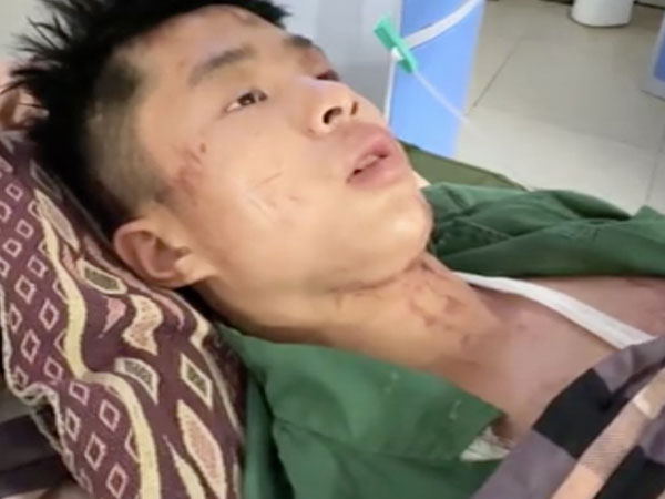 Ảnh bìa bài viết 954581