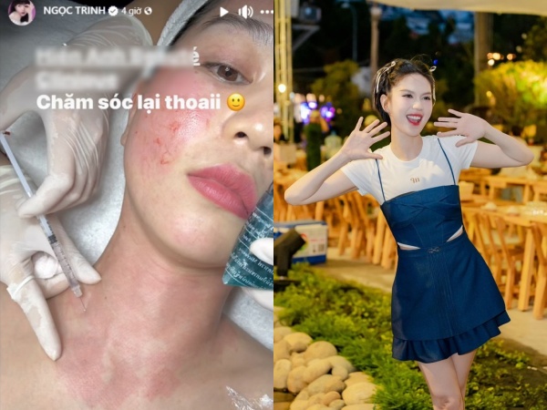 Ảnh bìa bài viết 958083