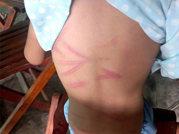 Ảnh bìa bài viết 959781