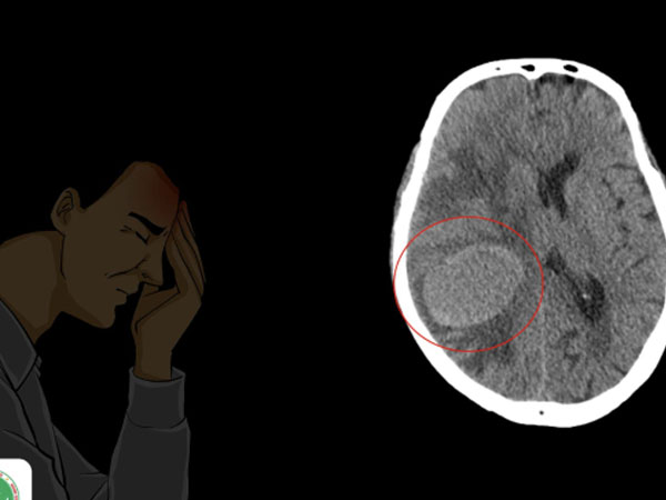 Ảnh bìa bài viết 960815