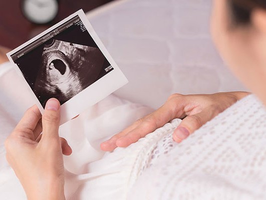 Ảnh bìa bài viết 961713