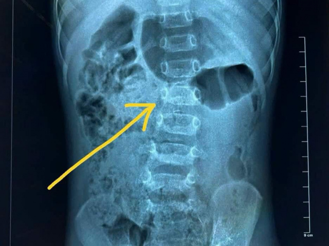 Ảnh bìa bài viết 966667