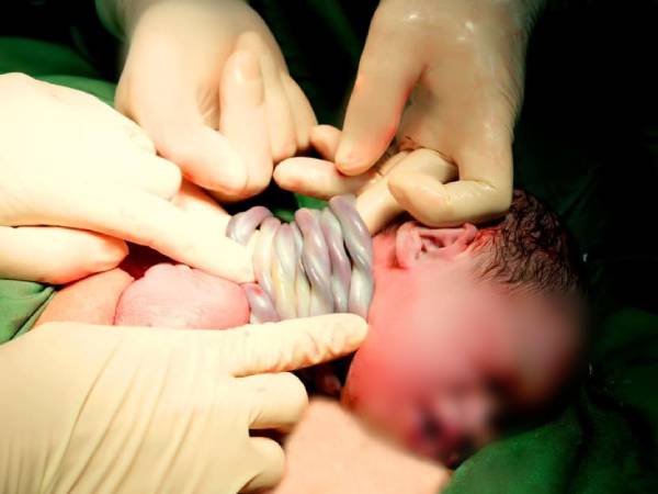 Ảnh bìa bài viết 969258