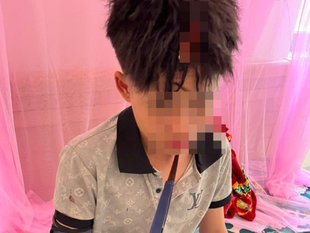 Ảnh bìa bài viết 977744