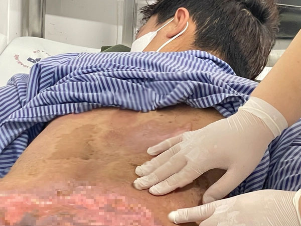 Ảnh bìa bài viết 981596