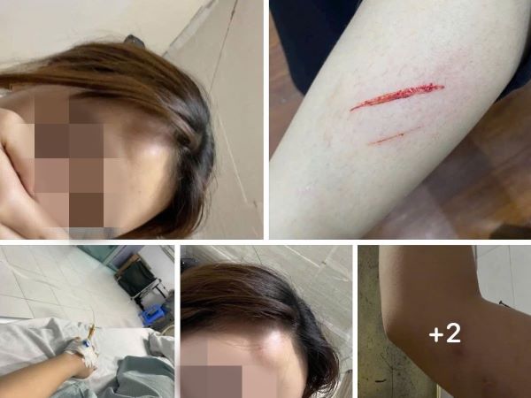 Ảnh bìa bài viết 983191