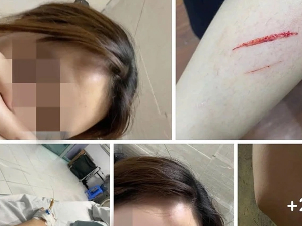 Ảnh bìa bài viết 983200