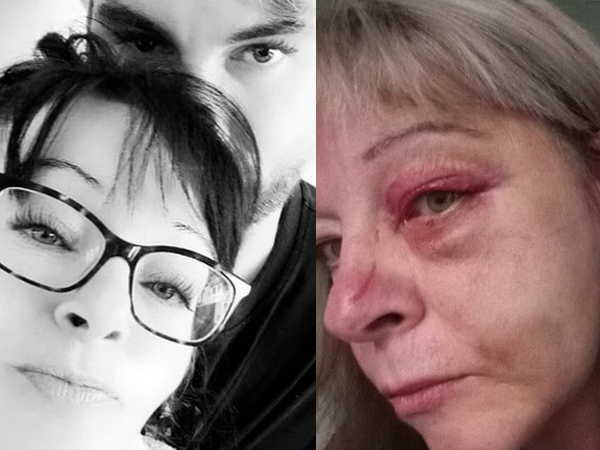 Ảnh bìa bài viết 984094