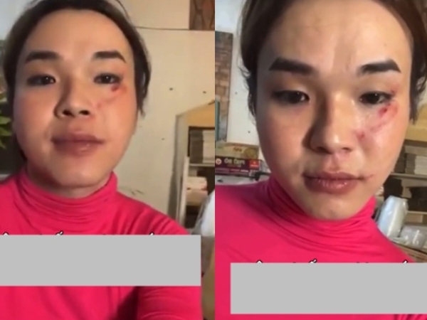 Ảnh bìa bài viết 984823