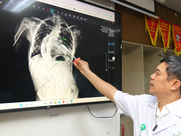 Ảnh bìa bài viết 985908