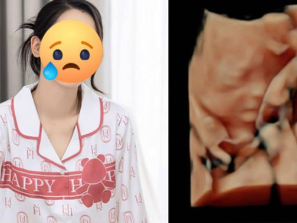 Ảnh bìa bài viết 986155