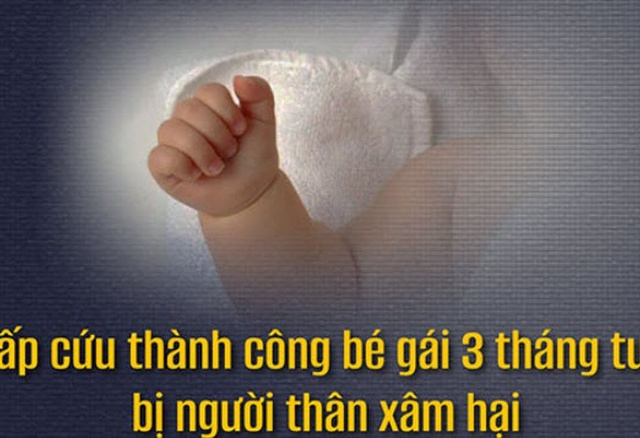 Ảnh bìa bài viết 993369