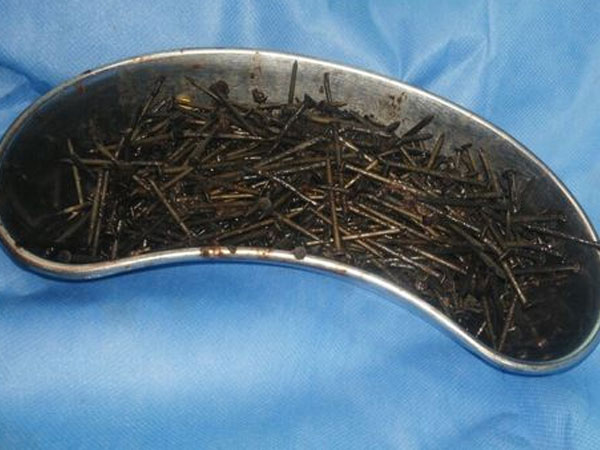 Ảnh bìa bài viết 493998