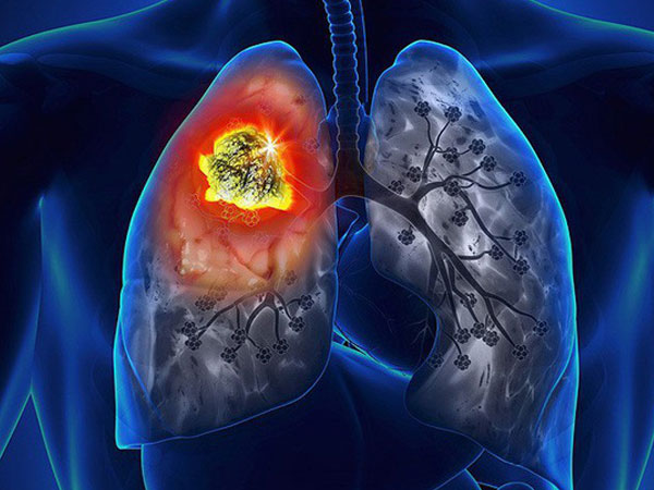 Ảnh bìa bài viết 504983