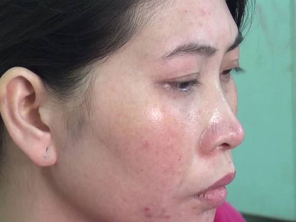 Ảnh bìa bài viết 506310
