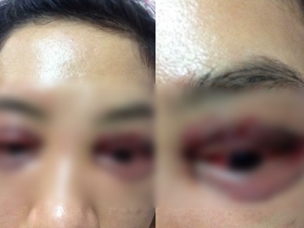 Ảnh bìa bài viết 510664