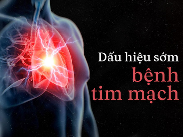 Ảnh bìa bài viết 520325