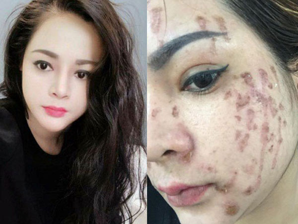 Ảnh bìa bài viết 521073