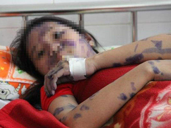 Ảnh bìa bài viết 521668