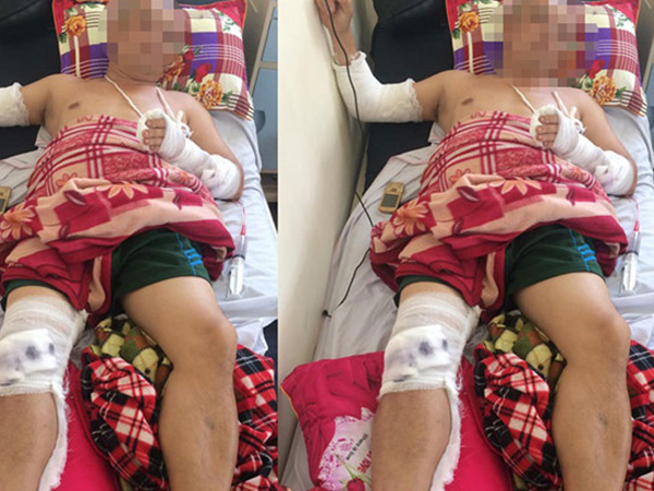 Ảnh bìa bài viết 521808