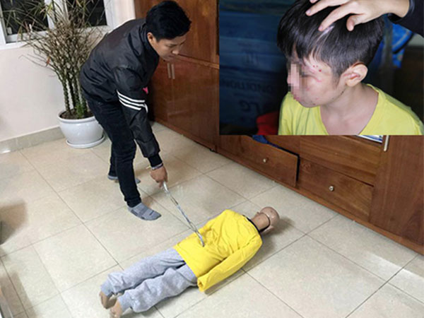 Ảnh bìa bài viết 523546