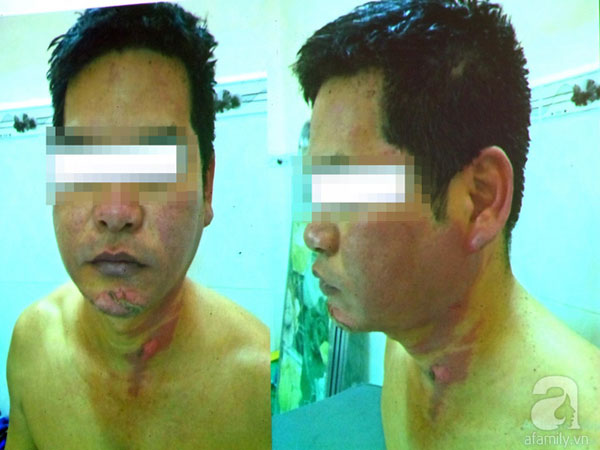 Ảnh bìa bài viết 524905