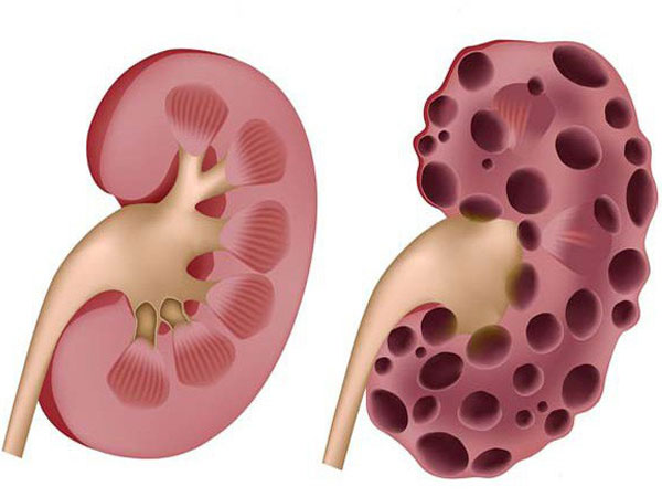 Ảnh bìa bài viết 529670