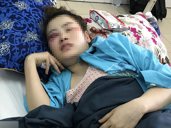 Ảnh bìa bài viết 529784