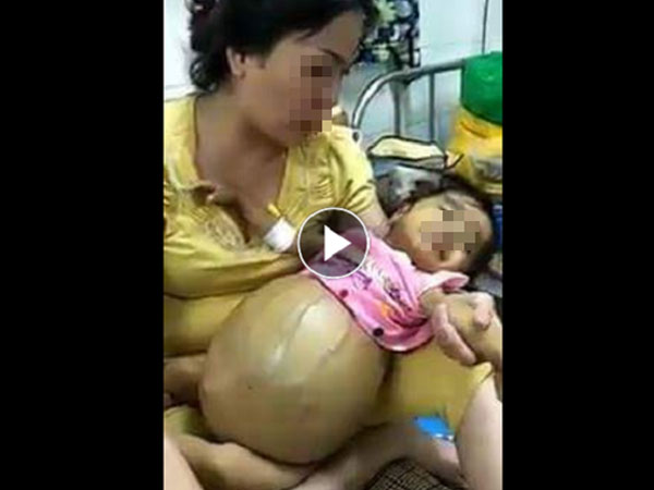 Ảnh bìa bài viết 530069