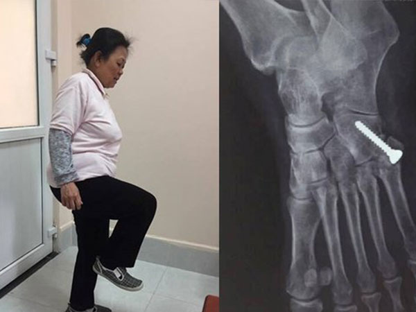 Ảnh bìa bài viết 534038