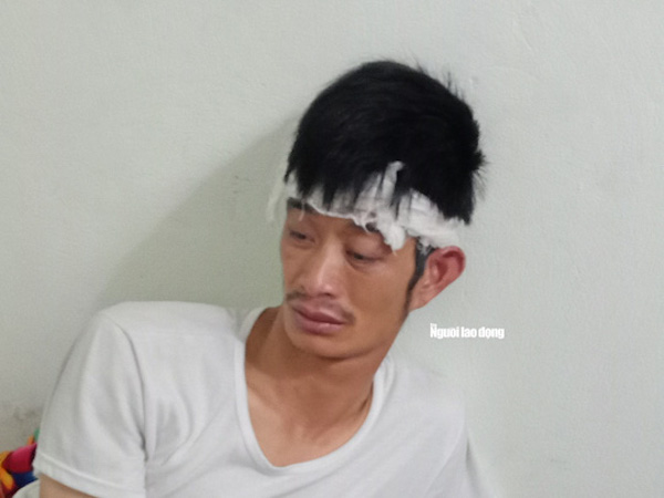 Ảnh bìa bài viết 537646