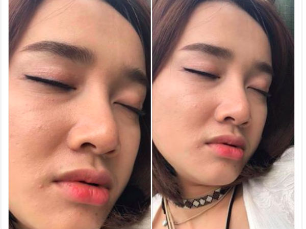 Ảnh bìa bài viết 539688