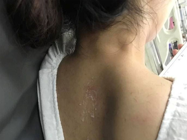 Ảnh bìa bài viết 540669