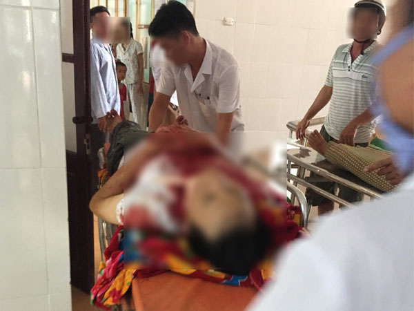 Ảnh bìa bài viết 541237