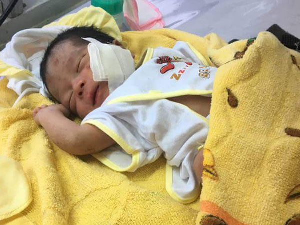 Ảnh bìa bài viết 542143