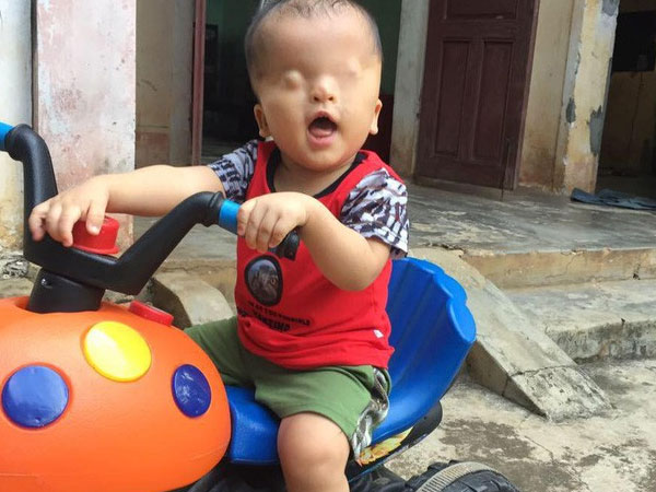 Ảnh bìa bài viết 548123