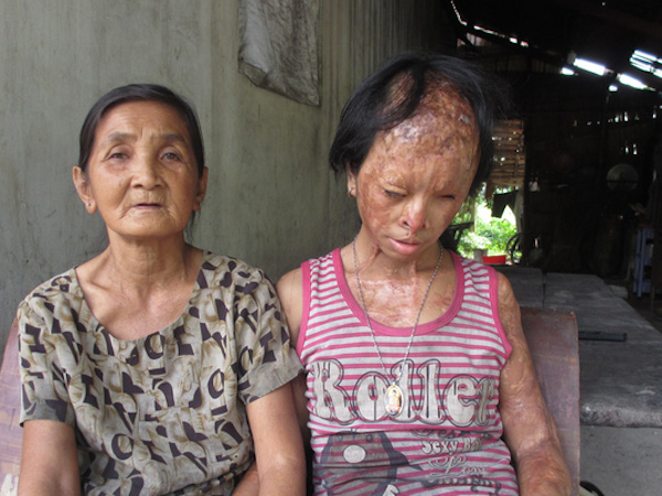 Ảnh bìa bài viết 555510