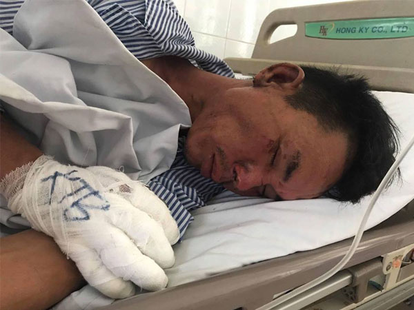 Ảnh bìa bài viết 556496