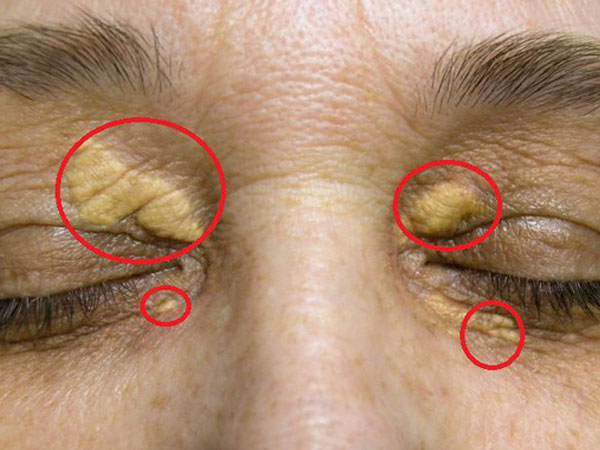 Ảnh bìa bài viết 556770