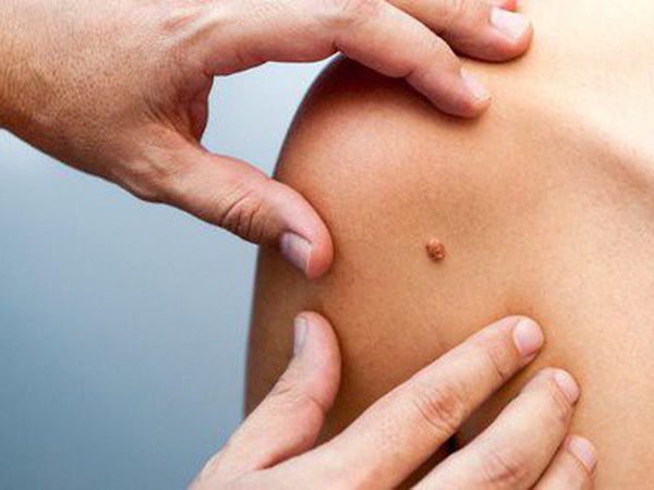 Ảnh bìa bài viết 557444