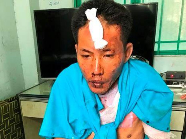 Ảnh bìa bài viết 560876