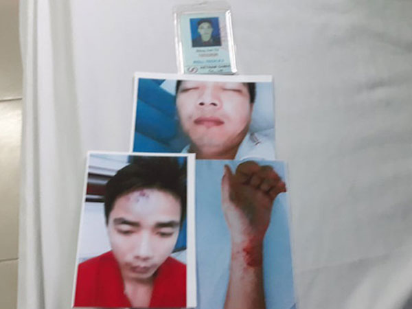 Ảnh bìa bài viết 563267